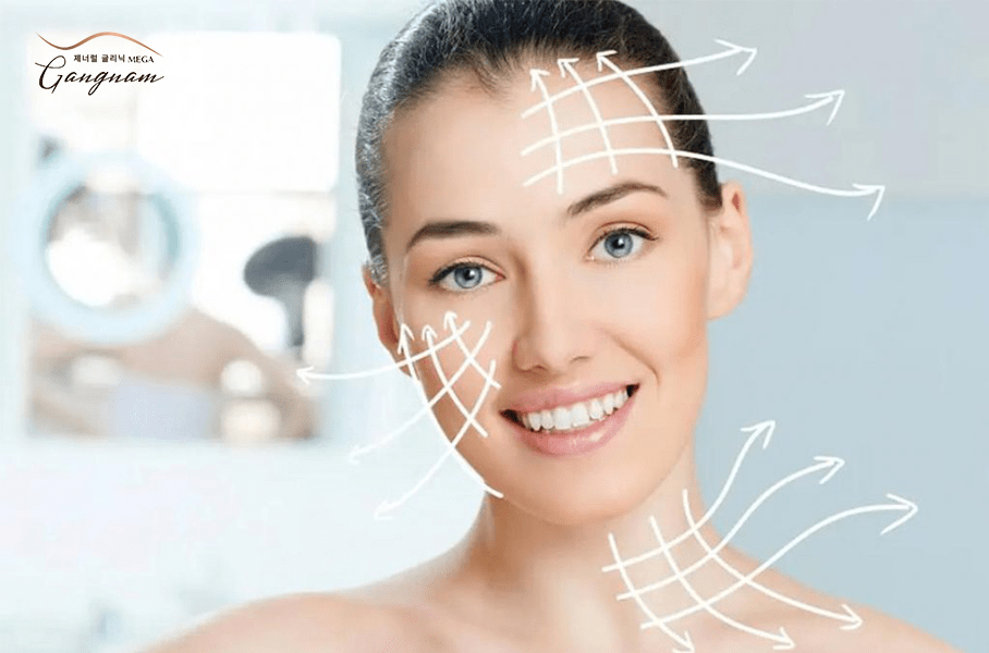 Dịch vụ căng chỉ collagen trên da mặt có tốt không?