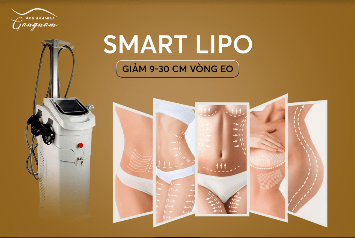 Smart Lipo giúp chị em giảm 9-30cm vòng eo chỉ trong 1 tháng