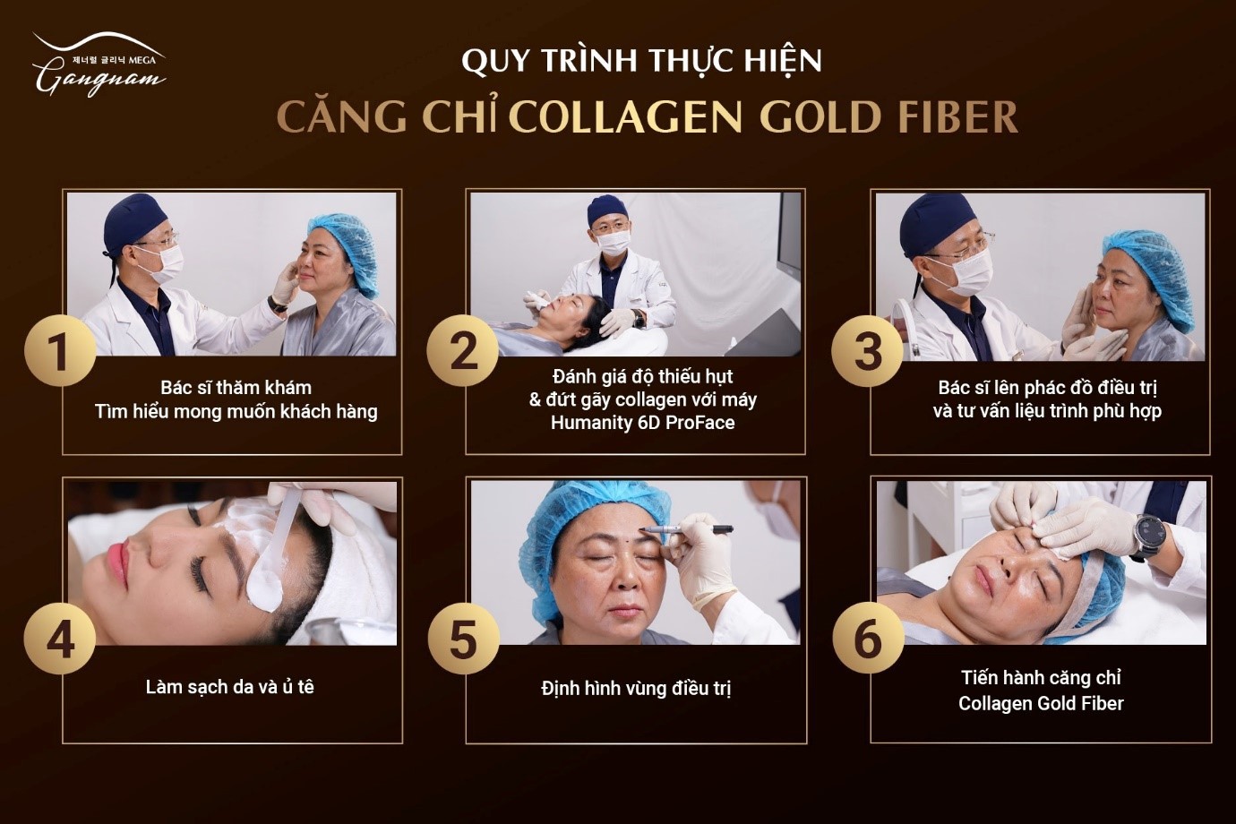 Quy trình thực hiện căng chỉ Collagen Gold Fiber tại Mega Gangnam