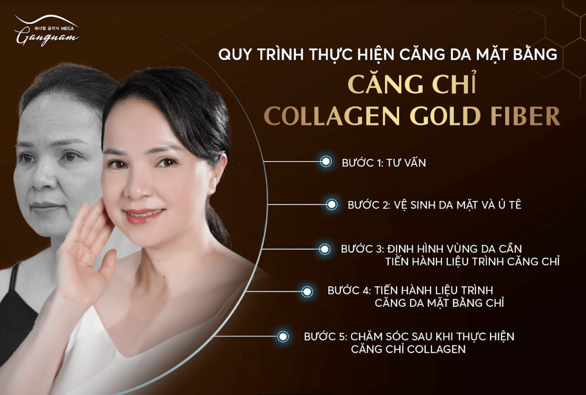 Quy trình thực hiện căng da mặt bằng chỉ collagen
