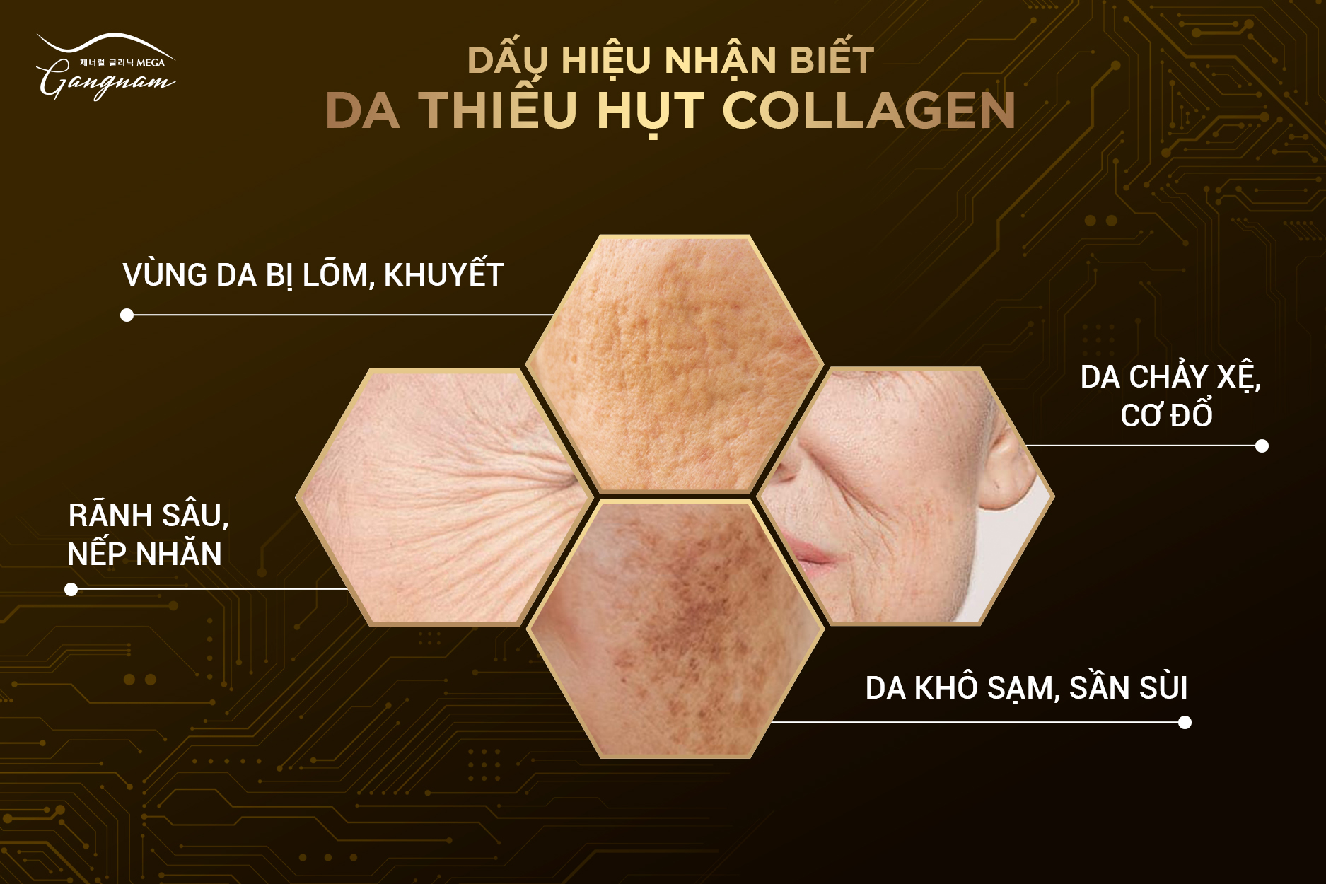 Những dấu hiệu nhận biết làn da thiếu hụt collagen