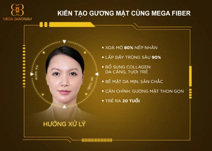 Hình ảnh phác họa kiến tạo gương mặt độc bản với sau khi sử dụng dịch vụ Mega Fiber