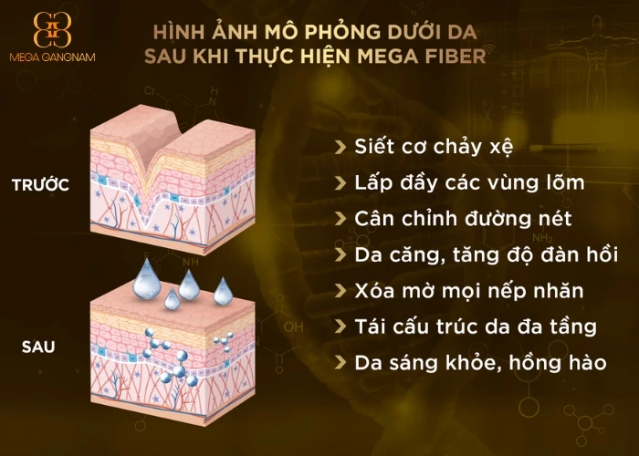 Hình ảnh mô phỏng dưới da sau khi thực hiện liệu trình Mega Fiber