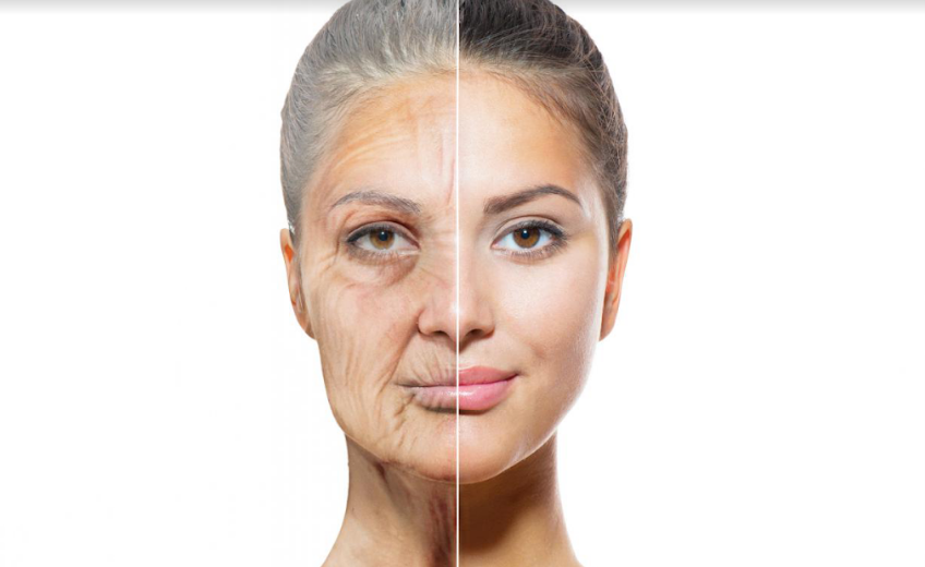 Căng da mặt là phương pháp giúp làm đẹp làn da 