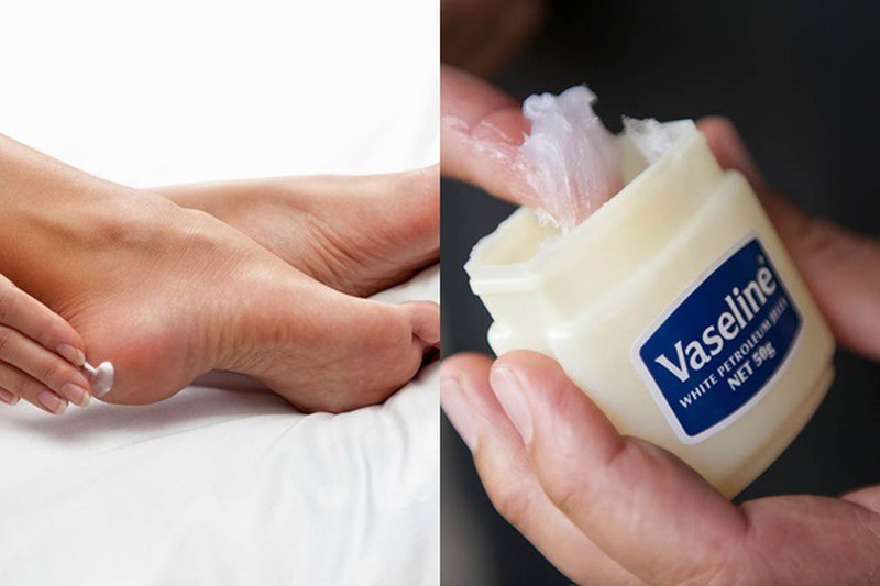 Thoa Vaseline trước khi đi ngủ để bàn chân được mềm mại hơn