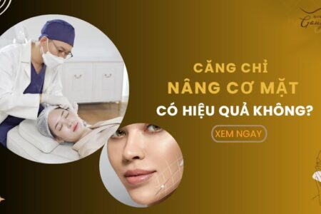 Hiệu quả của căng chỉ nâng cơ mặt dài từ 1-3 năm hoặc hơn tuỳ theo cơ địa