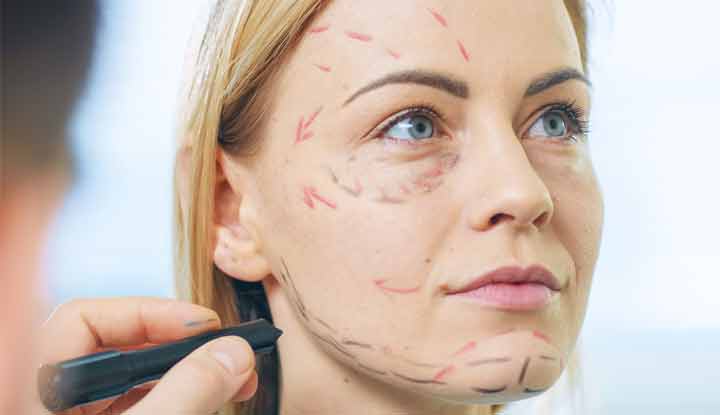 Tỷ lệ hy hữu của các tác dụng phụ sau căng da mặt vẫn có thể xảy ra