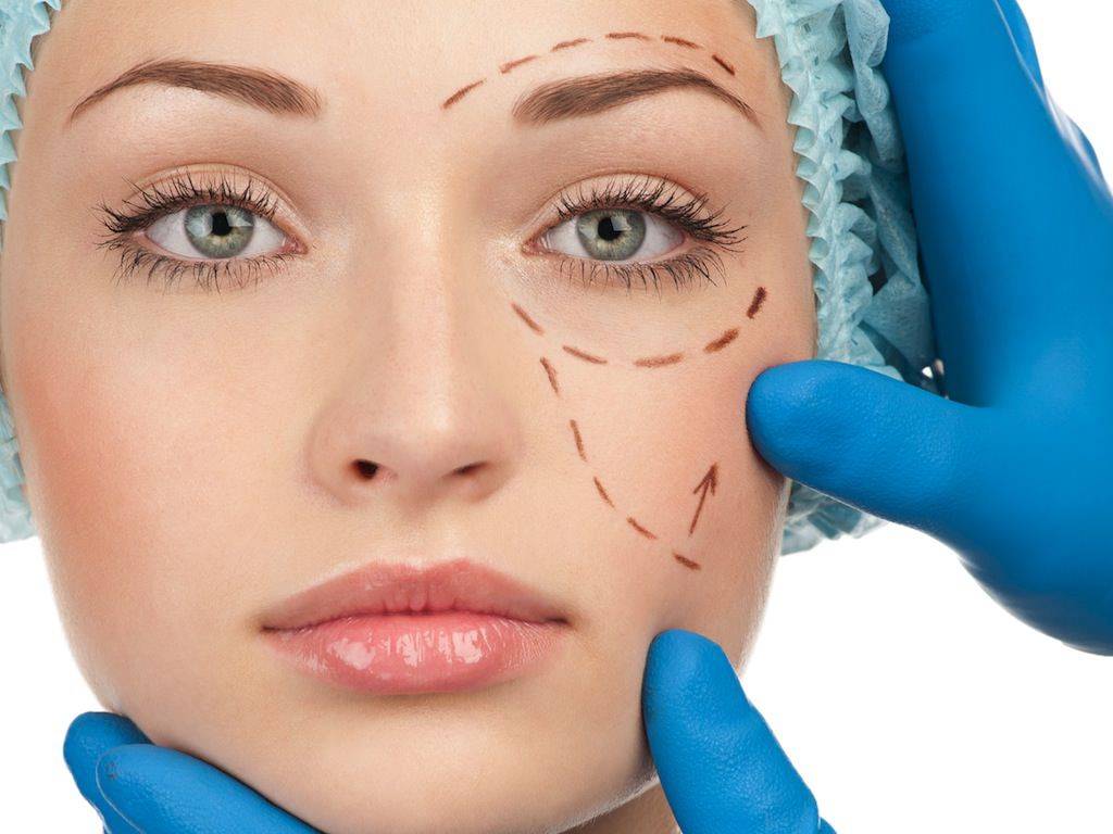 Quy trình phẫu thuật căng da mặt