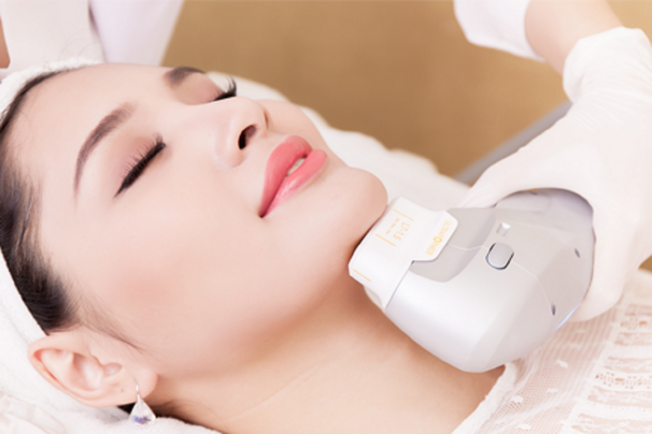 Công nghệ Ultherapy sử dụng sóng siêu âm tác động sâu ở dưới bề mặt da