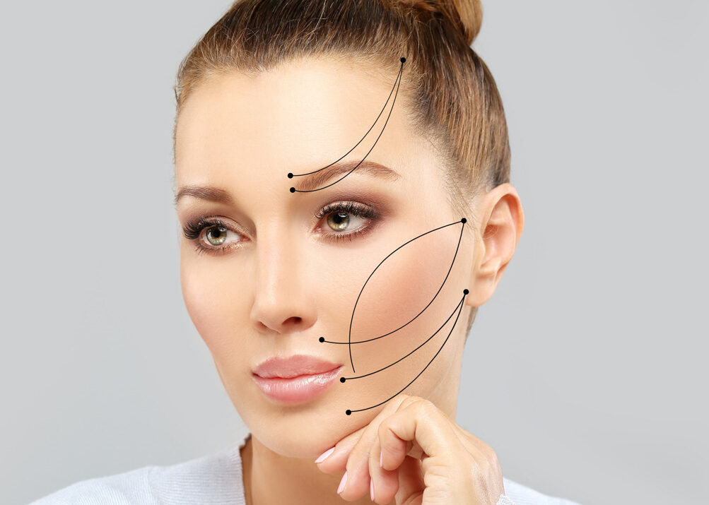 Đối tượng được khuyến khích trẻ hóa làn da bằng chỉ collagen Đối tượng được khuyến khích trẻ hóa làn da bằng chỉ collagen