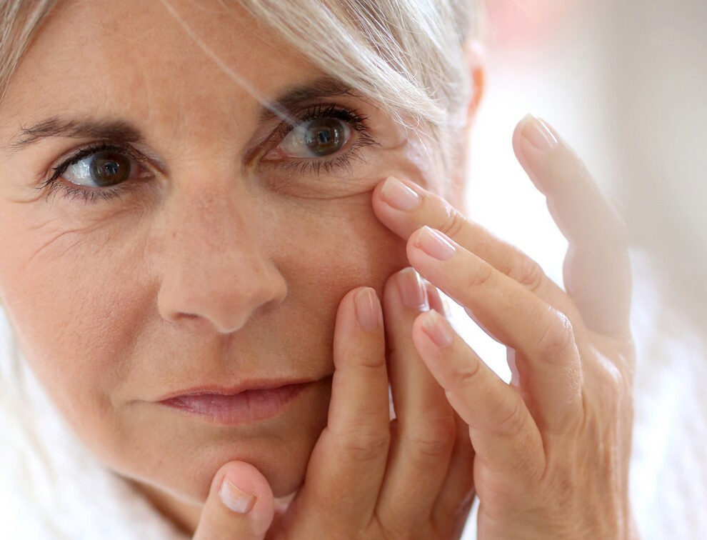 Hậu quả đáng tiếc do thực hiện căng da mặt bằng chất liệu chỉ không an toàn Hậu quả đáng tiếc do thực hiện căng da mặt bằng chất liệu chỉ không an toàn