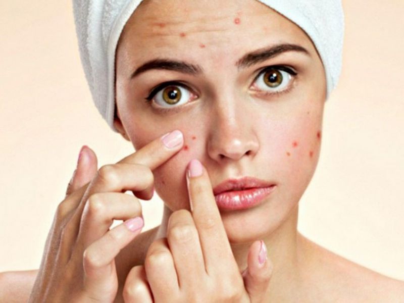 Chạm tay lên mặt rất dễ gây mụn nhọt do vi khuẩn ẩn nấp trên da