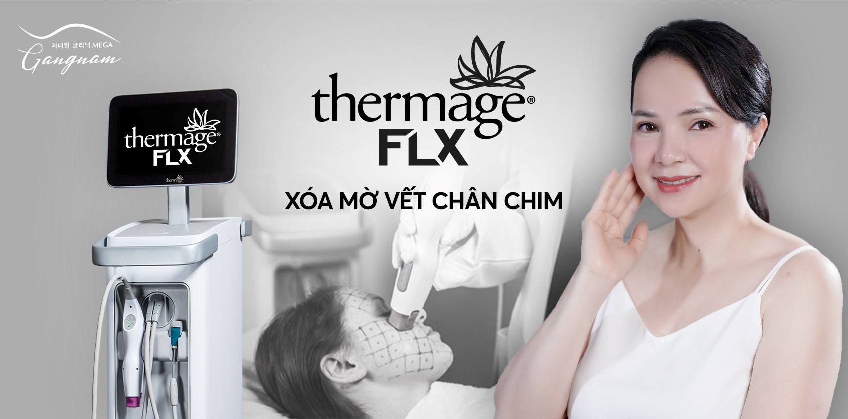 Công nghệ Thermage FLX xóa mờ vết chân chim