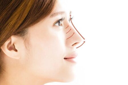 Nâng mũi bằng chỉ có hại gì đến sức khỏe và sắc đẹp không?