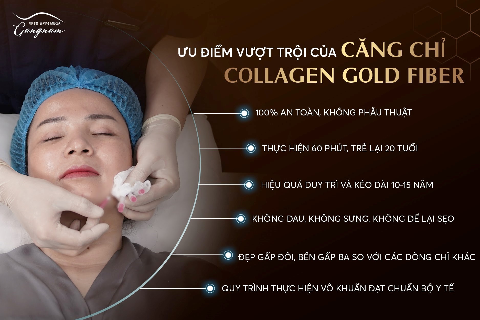Nâng mũi bằng căng chỉ collagen có tốt không? 