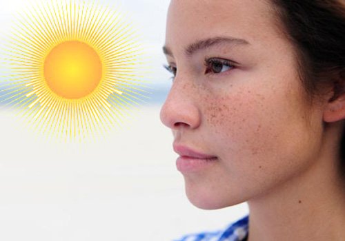 Tia UV do ánh nắng mặt trời rất dễ gây nên tình trạng nám da