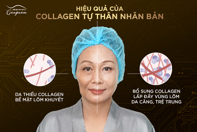 Hiệu quả đạt được sau khi thực hiện liệu trình Collagen tự thân nhân bản