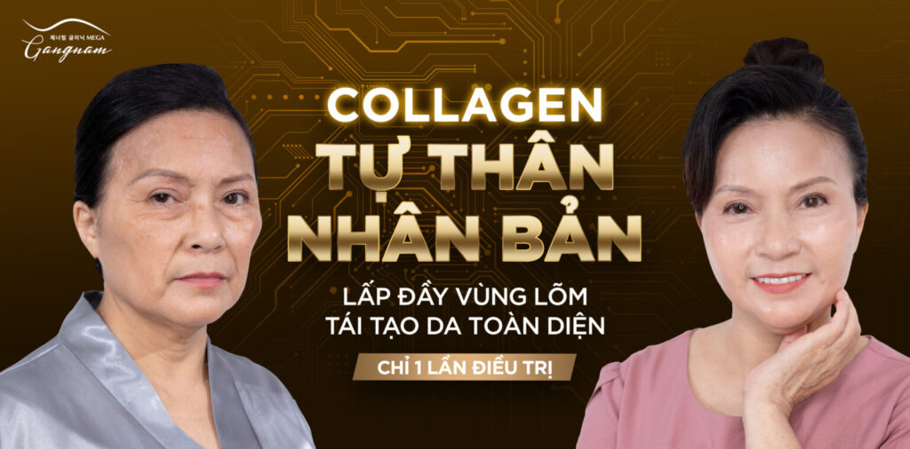 Tác dụng vượt trội khi sử dụng công nghệ cấy Collagen tự thân nhân bản