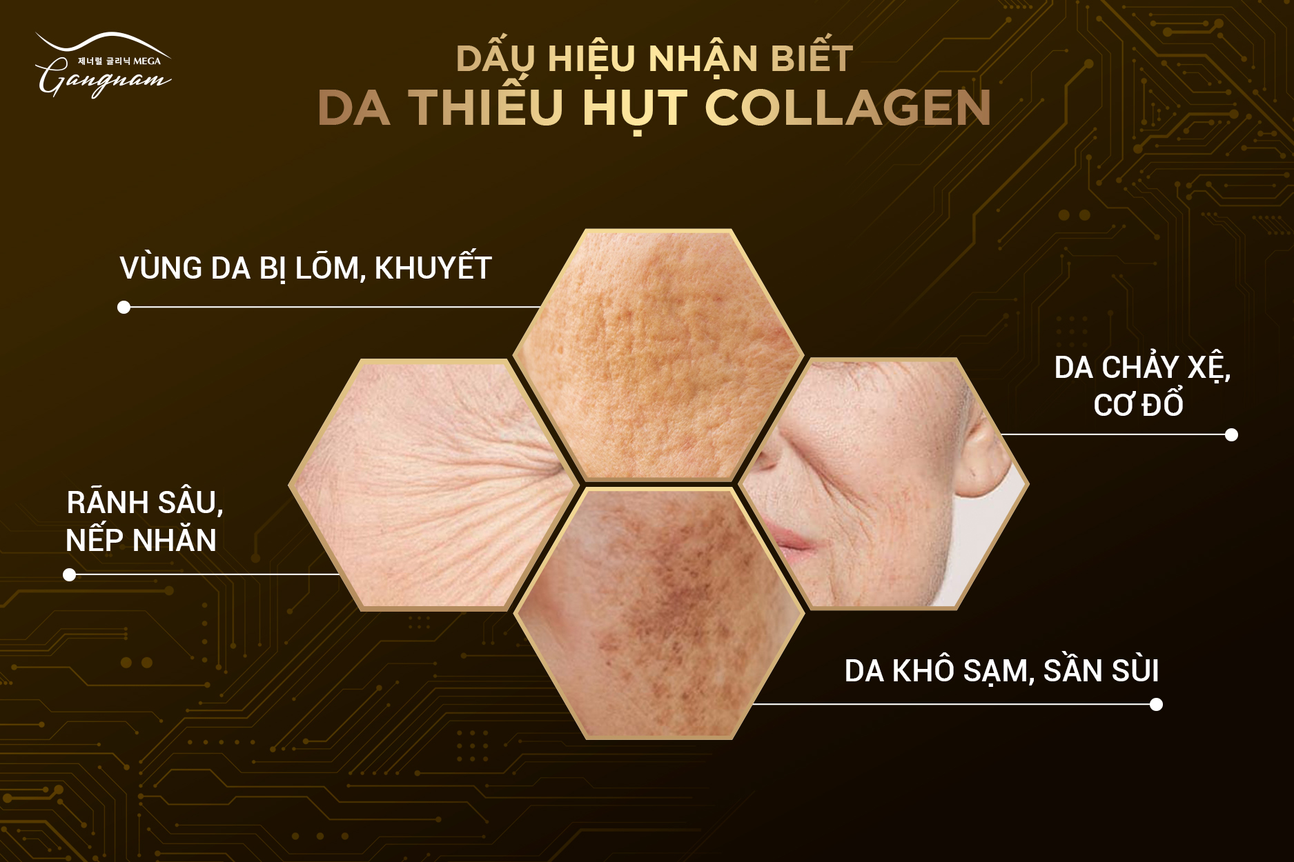 Tình trạng da khi bị thiếu hụt collagen. Đa số tình trạng xảy ra khi bạn tới độ tuổi da bị lão hoá 