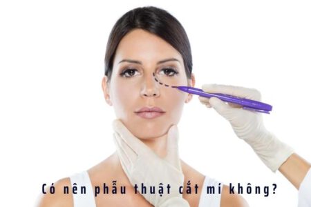 Có nên phẫu thuật cắt mí mắt hay không? Tại sao?