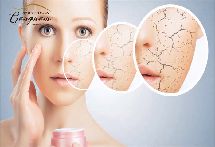 Công dụng của mặt nạ dưỡng ẩm đối với làn da nhiều khuyết điểm
