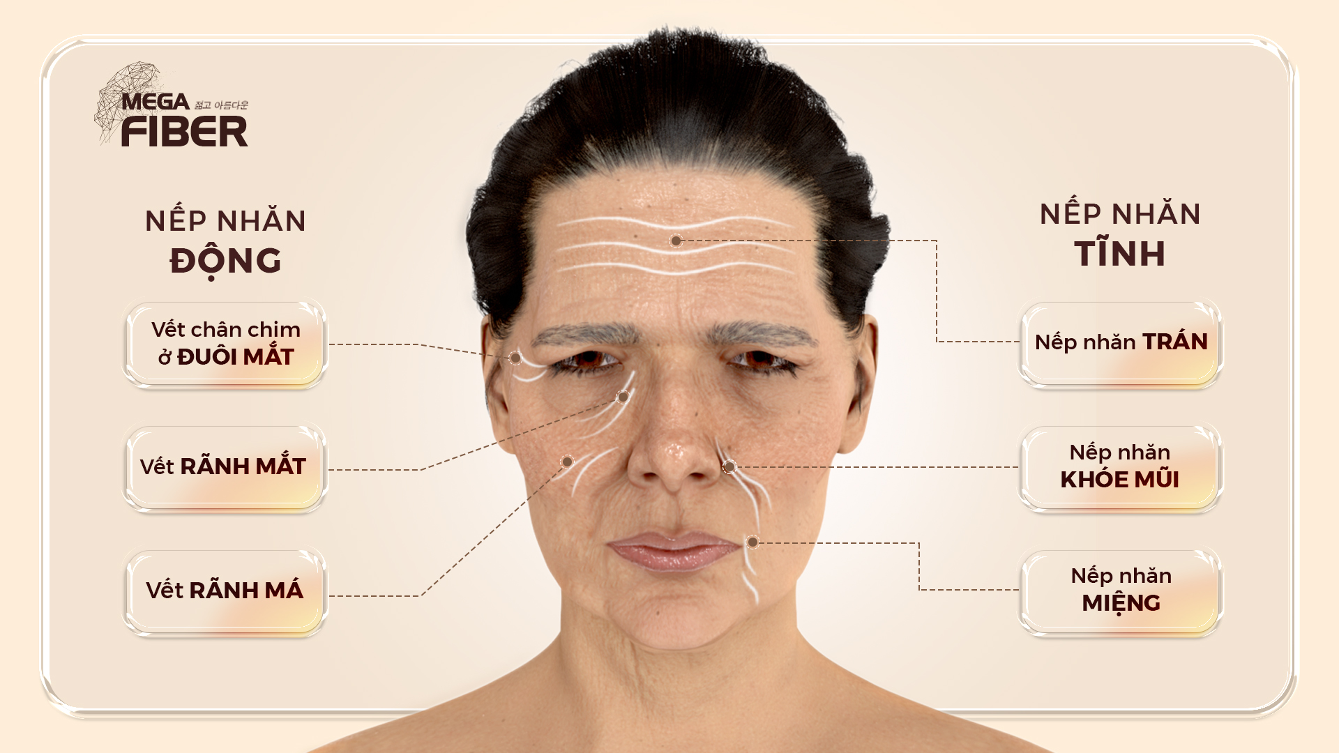 Cơ chế lão hóa da và cách điều trị hiệu quả