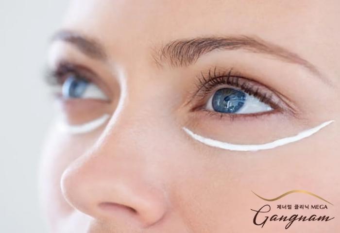Những cách điều trị dấu hiệu lão hóa da vùng dưới mắt theo chỉ định của bác sĩ