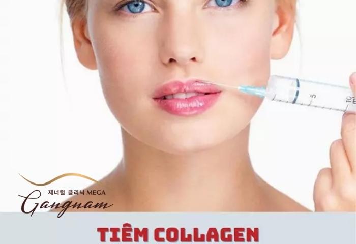Tiêm collagen cho vùng môi có an toàn và hiệu quả không?