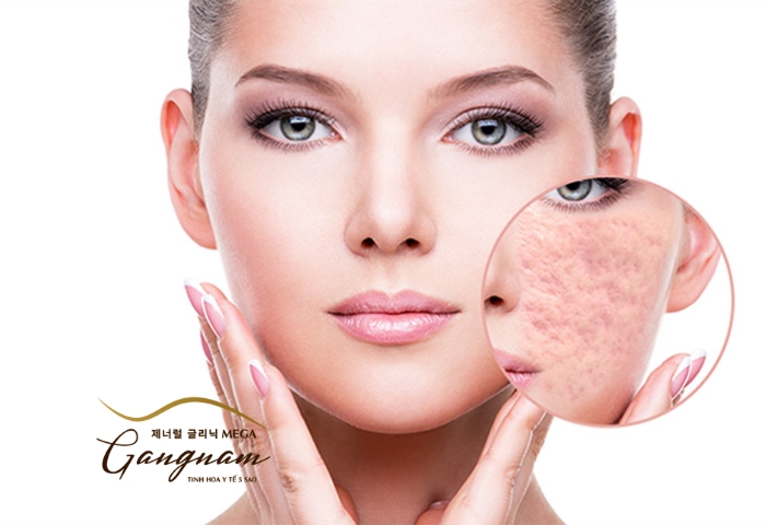 Tổng hợp những yếu tố nguy cơ và nguyên nhân gây sẹo vùng mặt