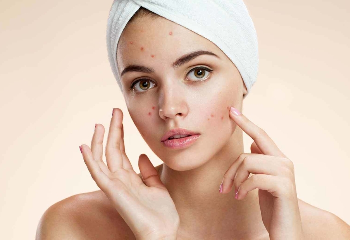 Các bước chăm sóc da mặt cần thiết cho làn da đổ nhiều dầu