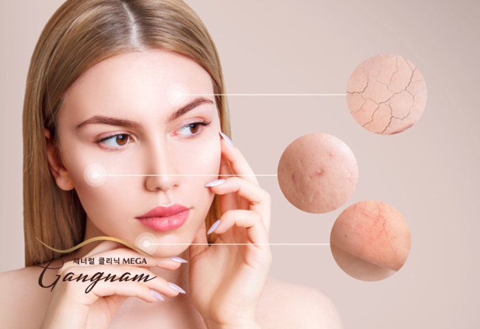Cách chăm sóc da mặt đúng cách cho làn da nhiều đặc điểm trên mặt