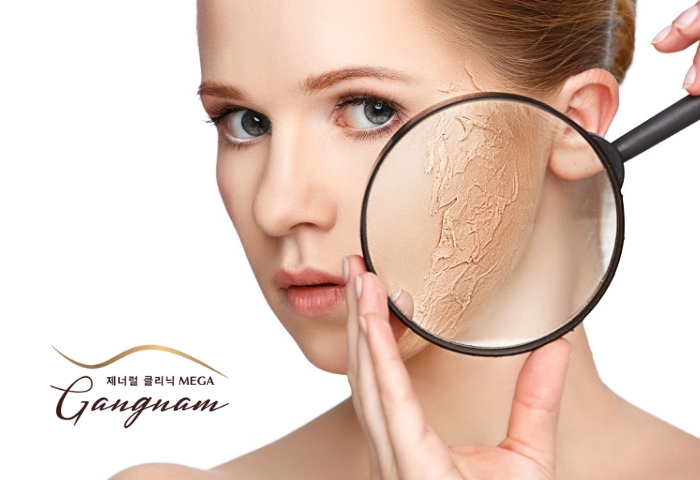 Tình trạng da mặt bị khô là như thế nào? Cách khắc phục hiệu quả nhất?
