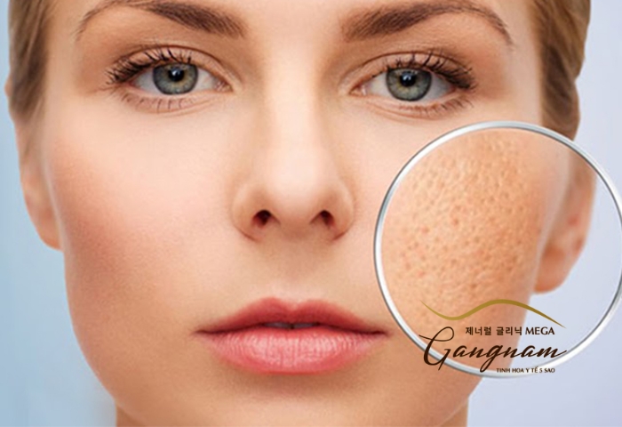 Da mặt sần sùi nguyên nhân chính là gì? Có thể điều trị được hay không?