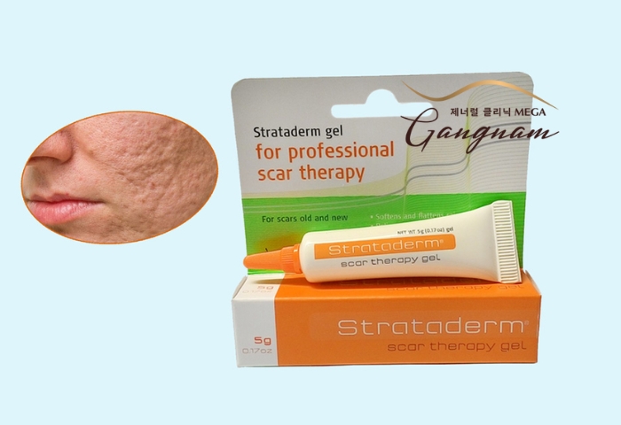 Cách dùng loại gel Strataderm trị nám như thế nào?