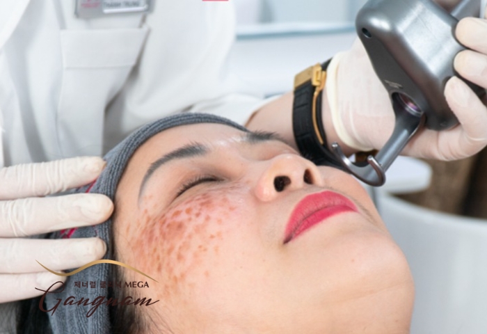 Technologies applied for treating skin melasma