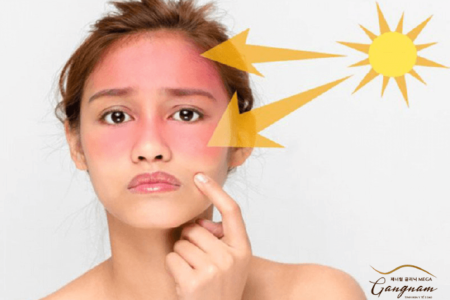 Cách nhận biết tình trạng da mặt bị cháy nắng