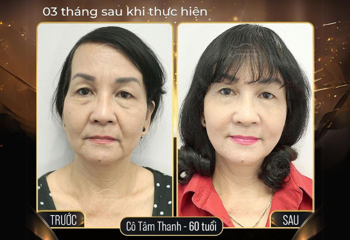 Khách hàng cô Thanh Tâm tại Đà Nẵng