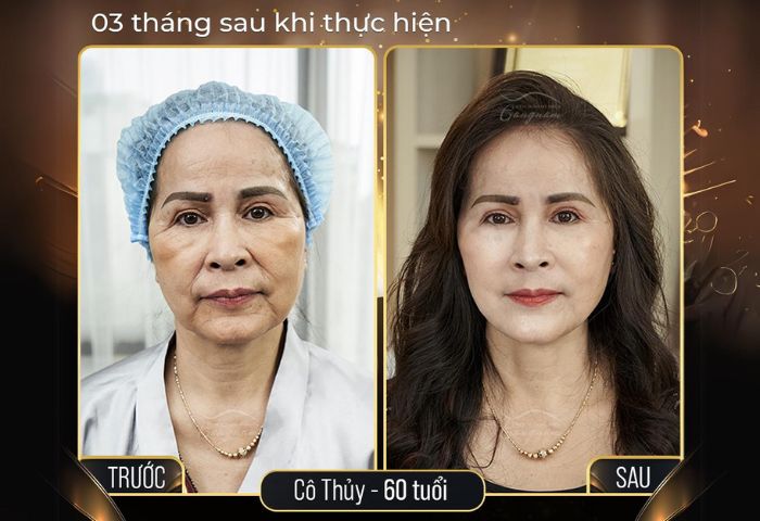Khách hàng cô Thu Thủy, 60 tuổi