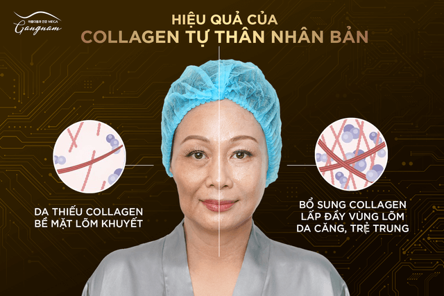 Công nghệ collagen tự thân nhân bản