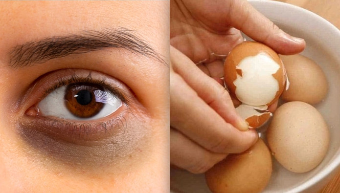 Trứng gà thường được áp dụng trong việc lăn giảm thâm bầm trên da