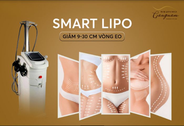 Giảm béo nhanh chóng tức thì bằng công nghệ Smart Lipo tại Mega Gangnam