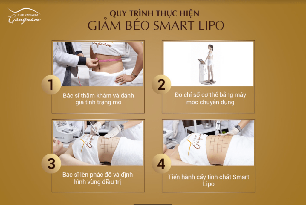 Quy trình thực hiện chuẩn y khoa của Smart Lipo tại Mega Gangnam