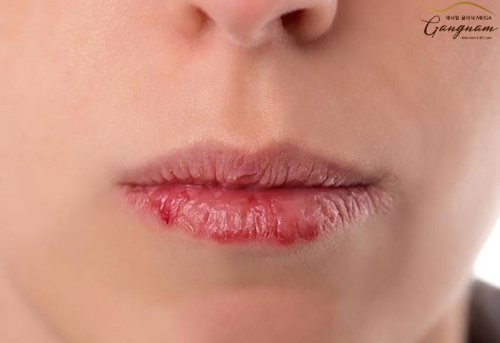 Nguyên nhân của việc phun môi không lên màu