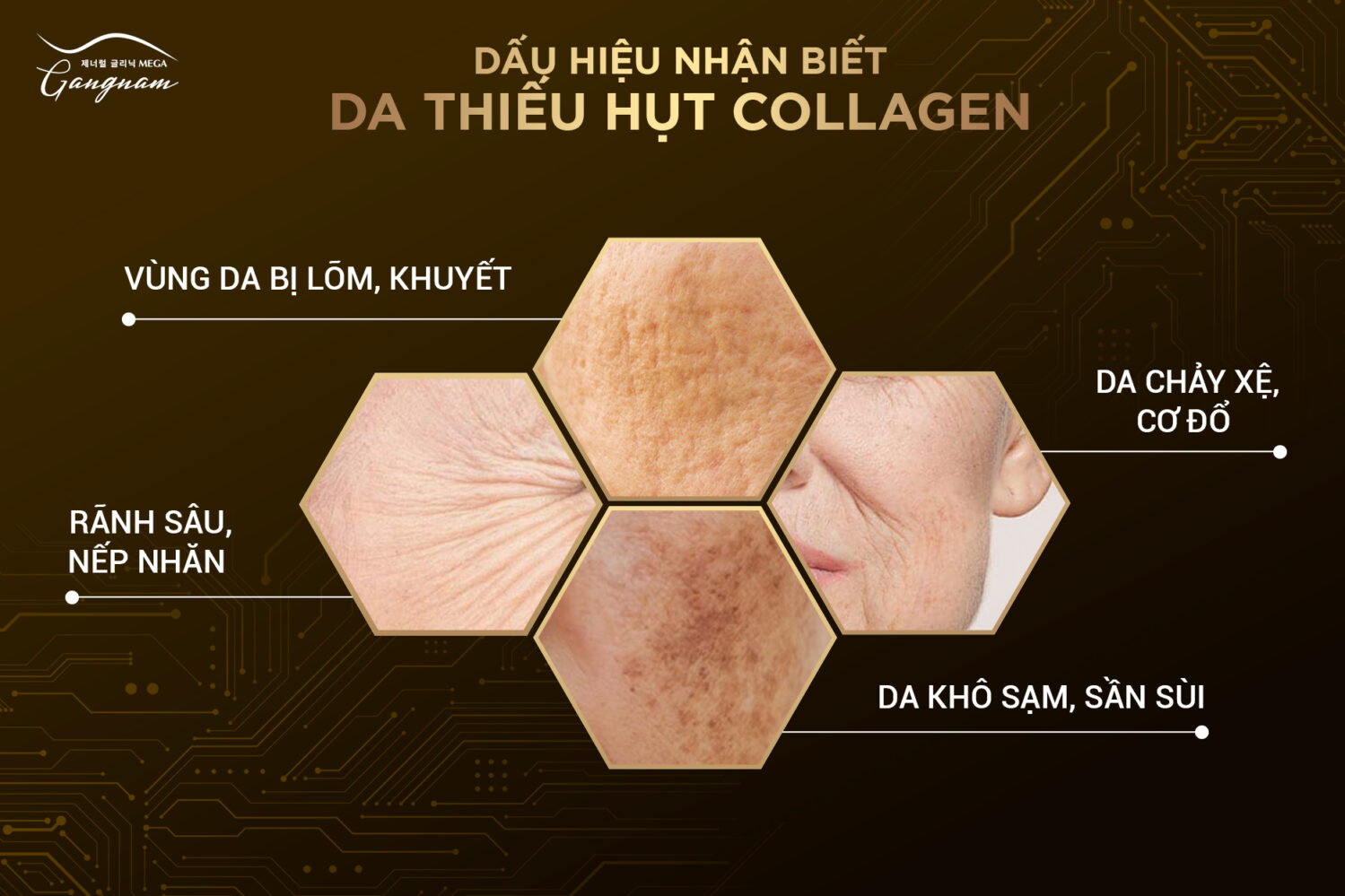Biểu hiện khi làn da của bạn đang thiếu hụt collagen 