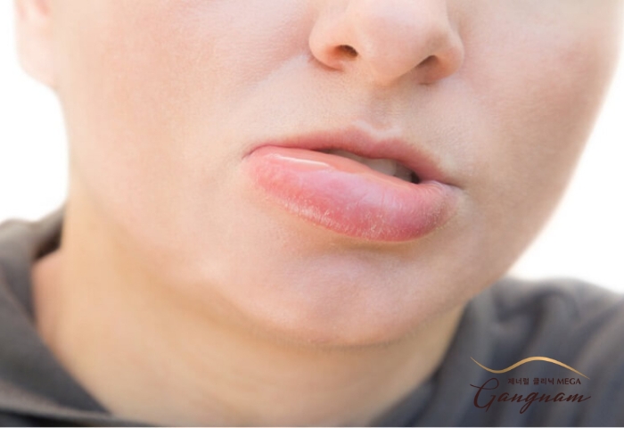 Xăm môi bị sưng là biểu hiện như thế nào? Giải đáp từ các chuyên gia!