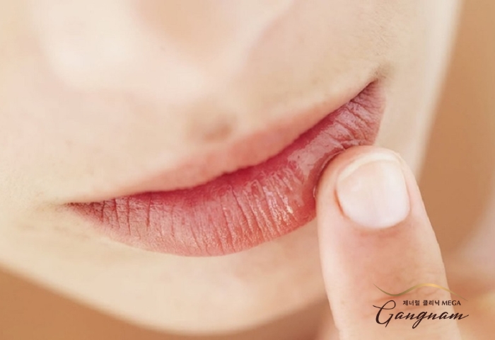 Chuyên gia giải thích nguyên nhân đau nhức sau khi xăm môi