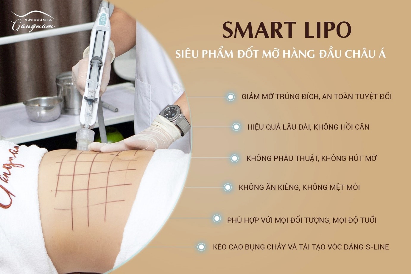 Lợi ích của Smart Lipo giải quyết triệt để các vùng mỡ cơ thể 