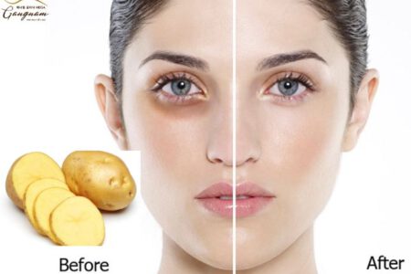 Đắp khoai tây lên mắt có tác dụng gì?