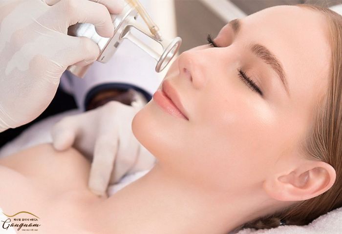 Phương pháp laser để xóa quầng thâm mắt