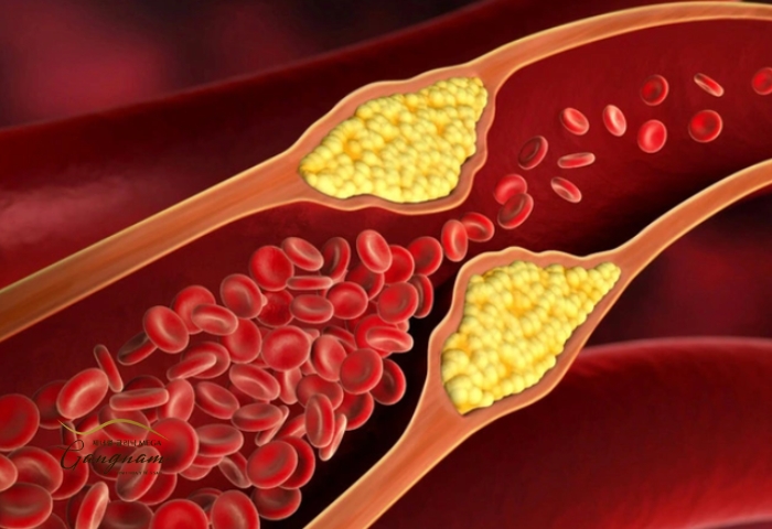 Một số loại thuốc có chức năng giảm cholesterol xấu và mỡ thừa trong mạch máu, nội tạng